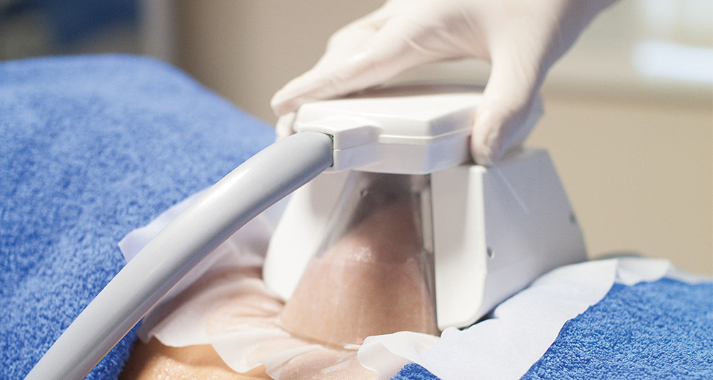 How Fat Freezing and HIFU Work Together? 2 Multiple Areas in One Session HIFU and Fat Freezing